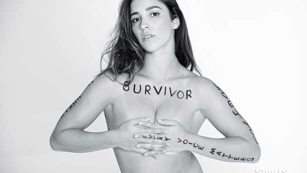 aly-survivor.jpg